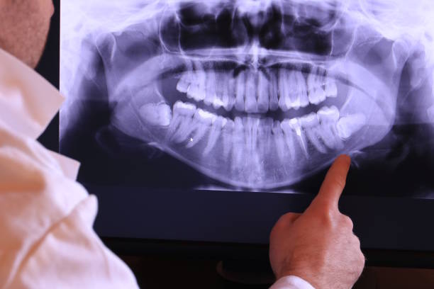 Best Urgent Care for Lost Fillings or Crowns in Mountlake Terrace, WA